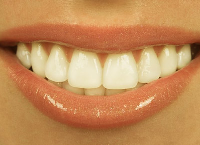 estética dental